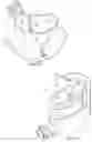 Fig. 08 - MINIMALLY INVASIVE EXPANDABLE VERTEBRAL IMPLANT AND METHOD