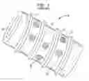 Fig. 02 - Intervertebral spacer device having a slotted partial circular domed arch strip spring