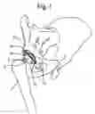 Fig. 02 - Acetabular cup