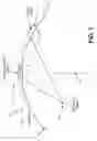 Fig. 02 - Multiple aperture ultrasound array alignment fixture