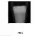 Fig. 02 - Gallium-doped phosphocalcic compounds