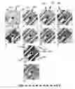 Fig. 08 - Automatic positioning and sensing microelectrode arrays