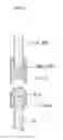 Fig. 06 - Instrument housing case