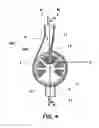 Fig. 04 - Clot trap, external functional means, blood circuit and treatment apparatus
