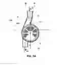 Fig. 05 - Clot trap, external functional means, blood circuit and treatment apparatus
