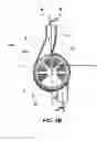 Fig. 06 - Clot trap, external functional means, blood circuit and treatment apparatus