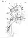 Fig. 02 - Harness for a handheld power equipment