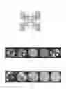 Fig. 02 - Method, equipment and applications for fast complete dissolution and hydrolysis of lignocellulosic biomass