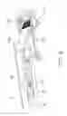 Fig. 09 - Detachable portable computing device