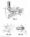 Fig. 02 - BODY-WORN WIRELESS TRANSDUCER MODULE