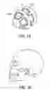 Fig. 09 - BODY-WORN WIRELESS TRANSDUCER MODULE