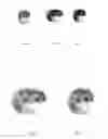Fig. 08 - Method for resolving contradicting output data from an optical character recognition (OCR) system, wherein the output data comprises more than one recognition alternative for an image of a character