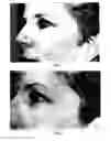 Fig. 02 - Topical compositions for anti-aging and methods of using same