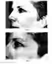Fig. 02 - Topical compositions for anti-aging and methods of using same