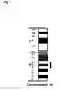 Fig. 02 - GENETIC DIAGNOSIS OF DEPRESSION