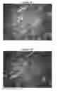 Fig. 06 - Magnetic resonance imaging contrast agents