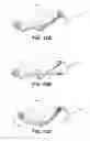 Fig. 13 - Exercise device