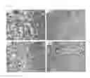 Fig. 14 - SOLID-SOLUTION CARBIDE/CARBONITRIDE POWDER AND METHOD FOR PREPARING THEREOF