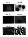 Fig. 03 - Methods of isolating methylated CpG islands