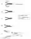 Fig. 01 - Method of preparing libraries of template polynucleotides
