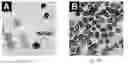 Fig. 18 - Methods for detecting fetal abnormality