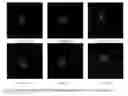 Fig. 19 - Methods for detecting fetal abnormality