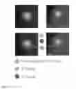 Fig. 20 - Methods for detecting fetal abnormality