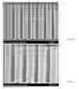 Fig. 44 - Methods for detecting fetal abnormality