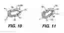 Fig. 06 - Heart wall tension reduction apparatus and method