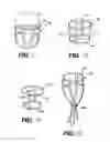 Fig. 07 - Heart wall tension reduction apparatus and method