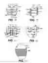 Fig. 09 - Heart wall tension reduction apparatus and method