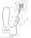 Fig. 08 - Remote position control for surgical apparatus