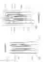 Fig. 09 - EXCHANGEABLE GUIDE-WIRE WITH BALLOON FOR FOREIGN BODY EXTRACTION