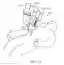 Fig. 09 - Medical robotic system with coupled control modes
