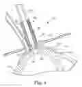 Fig. 07 - Auto-closure apical access positioner device and method