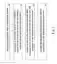 Fig. 02 - ASSISTING METHOD AND APPARATUS FOR RADIOTHERAPY