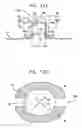 Fig. 08 - IMPLOSION TECHNIQUES FOR ULTRASOUND