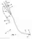 Fig. 02 - BALLOON CATHETER AND METHOD OF MANUFACTURE OF THE SAME