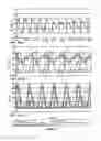 Fig. 09 - METHOD AND APPARATUS FOR INTRA-ARTICULAR INJECTION OR ASPIRATION