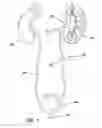 Fig. 02 - RENAL FLUSHING CATHETER