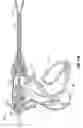 Fig. 09 - Electrosurgical tissue sealer and cutter