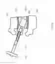 Fig. 06 - Minimally invasive cement delivery system retainer