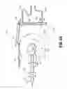 Fig. 45 - Flexible endoscopic stitching devices