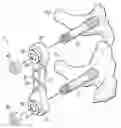 Fig. 01 - ELASTOMERIC SPINAL IMPLANT WITH LIMIT ELEMENT