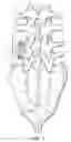 Fig. 02 - ELASTOMERIC SPINAL IMPLANT WITH LIMIT ELEMENT
