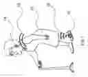 Fig. 02 - Method and device to manage freezing of gait in patients suffering from a movement disorder