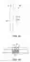 Fig. 07 - Torque lock anchor and methods and devices using the anchor