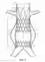 Fig. 02 - Self-flaring active fixation element for a stent graft