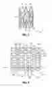 Fig. 02 - Stents with high radial strength and methods of manufacturing same