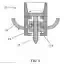 Fig. 07 - Joint prosthesis attachment system, device and method